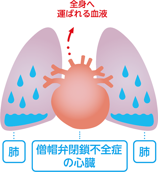 僧帽弁閉鎖不全症について｜心臓病｜ペットの病気予防・治療について