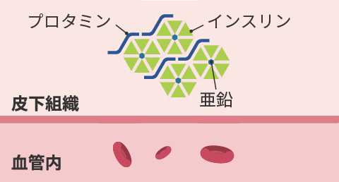 画像:皮下投与されたプロジンク®が血中に吸収されるまでのイメージ