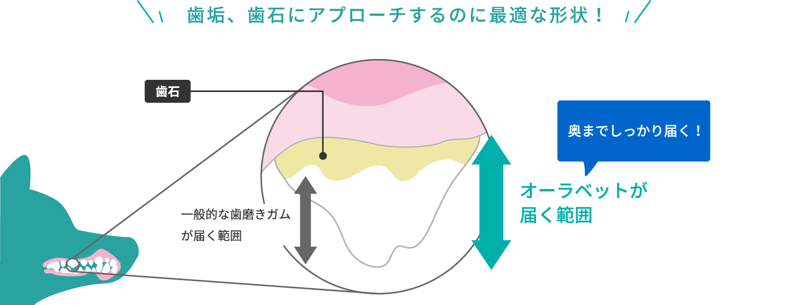 画像:歯垢、歯石にアプローチするのに最適な形状!