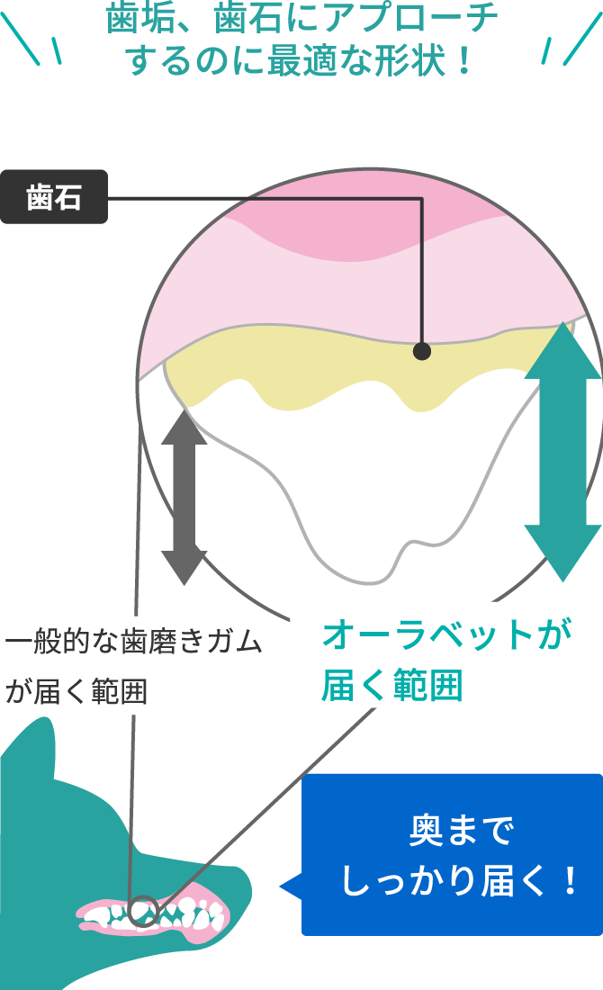 画像:歯垢、歯石にアプローチするのに最適な形状!