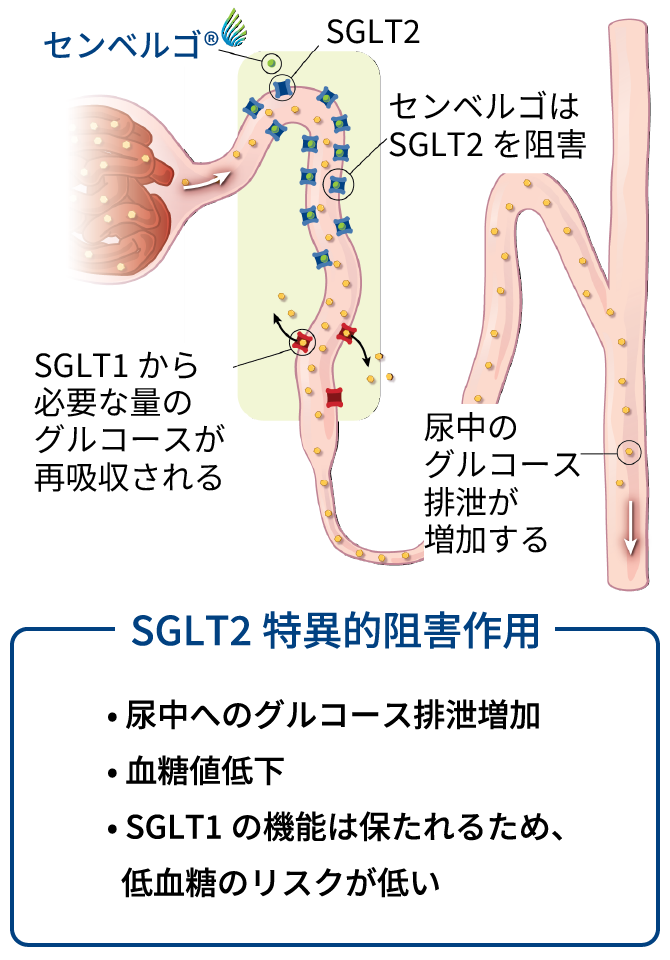 画像：センベルゴは尿細管でのグルコース再吸収を阻害